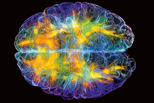 Esta gráfica de un cerebro humano ilustra el tema La maraña asombrosa dentro de nuestras cabezas nos hace lo que somos, en editoriallapaz.