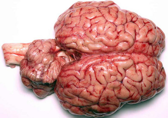 El cerebro humano pesa un promedio de solo 1.3 kilogramos pero es tan poderosa y complicada que queda muy corta la comparación con una computadora.
